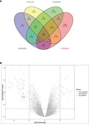 Identification of CFHR4 associated with poor prognosis of hepatocellular carcinoma